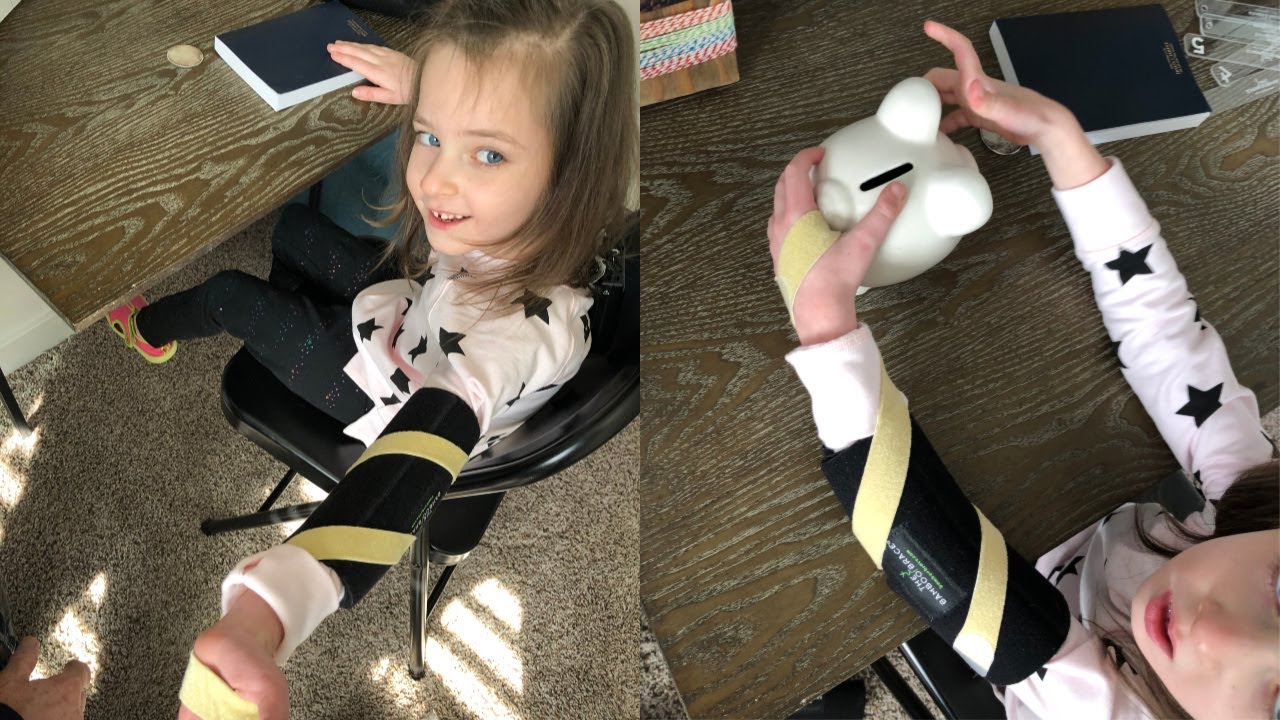 Bamboo Brace Paired with Supinator Strap for Quadriplegia