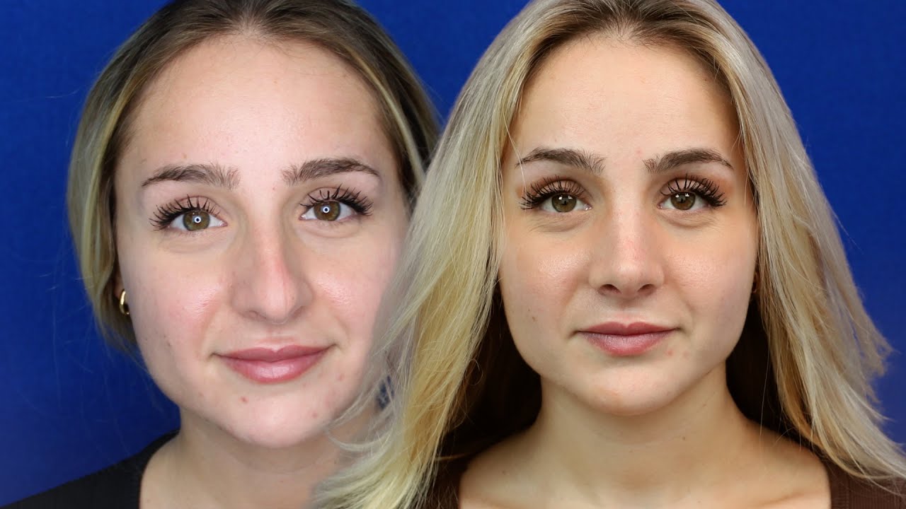 What makes a beautiful Nose ? | Balanced Rhinoplasty | natural Nose!