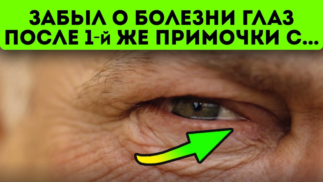 Окулист не поверил! Избавился от слезоточивости с помощью простой...