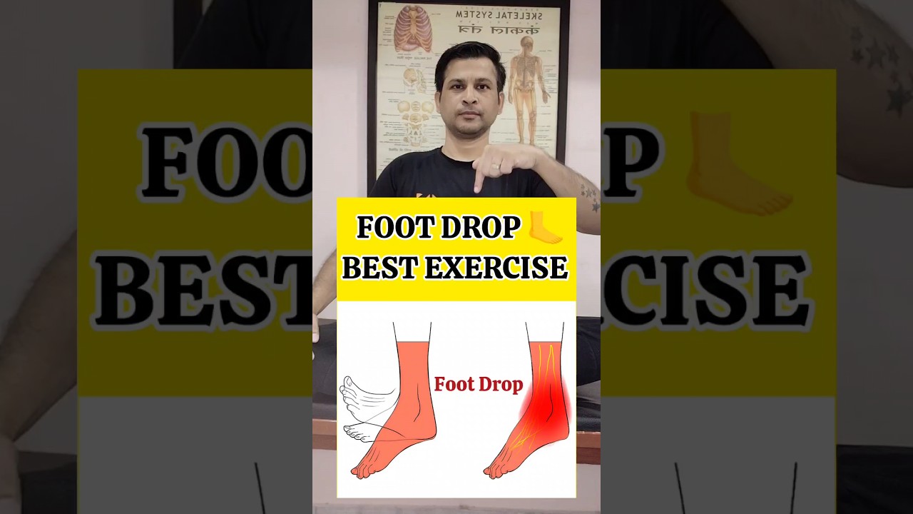 Best Exercise for FOOT DROP Recovery #shorts #physiotherapy
