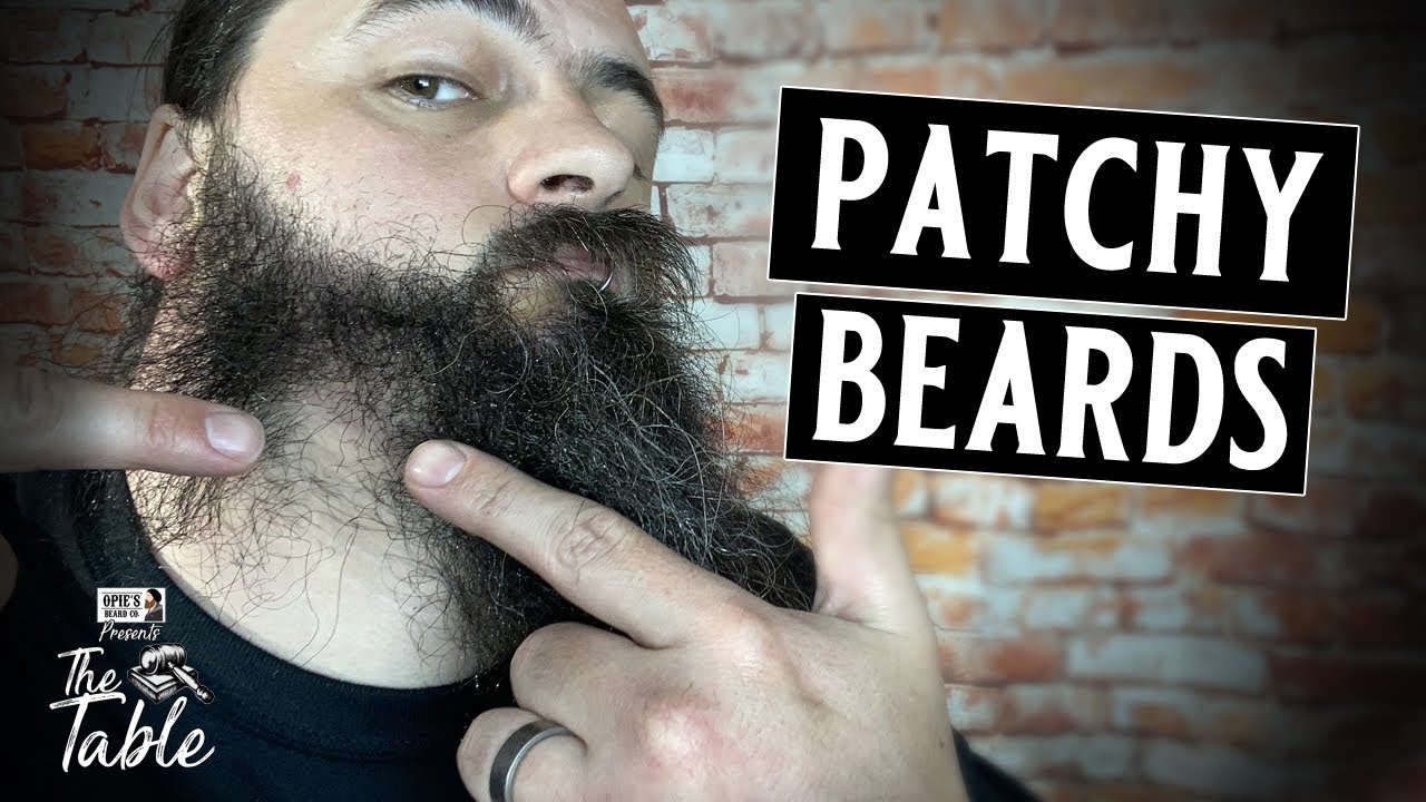 Patchy beards