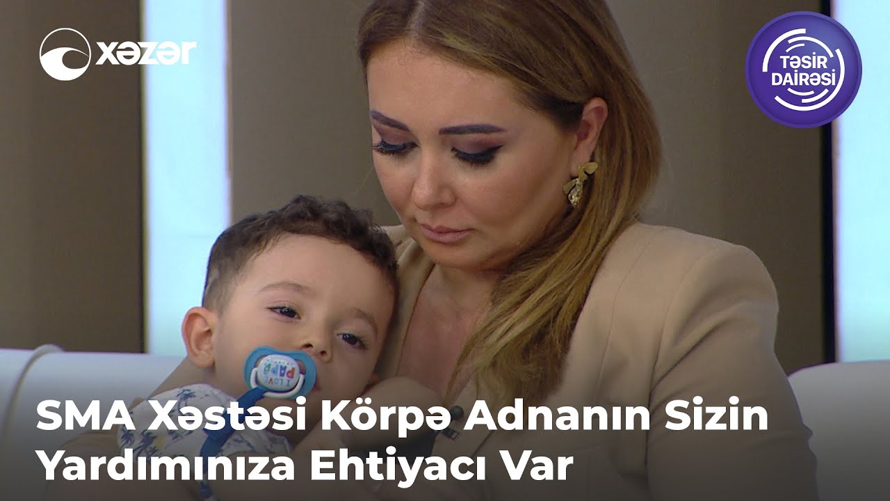 SMA Xəstəsi Körpə Adnanın Sizin Yardımınıza Ehtiyacı Var