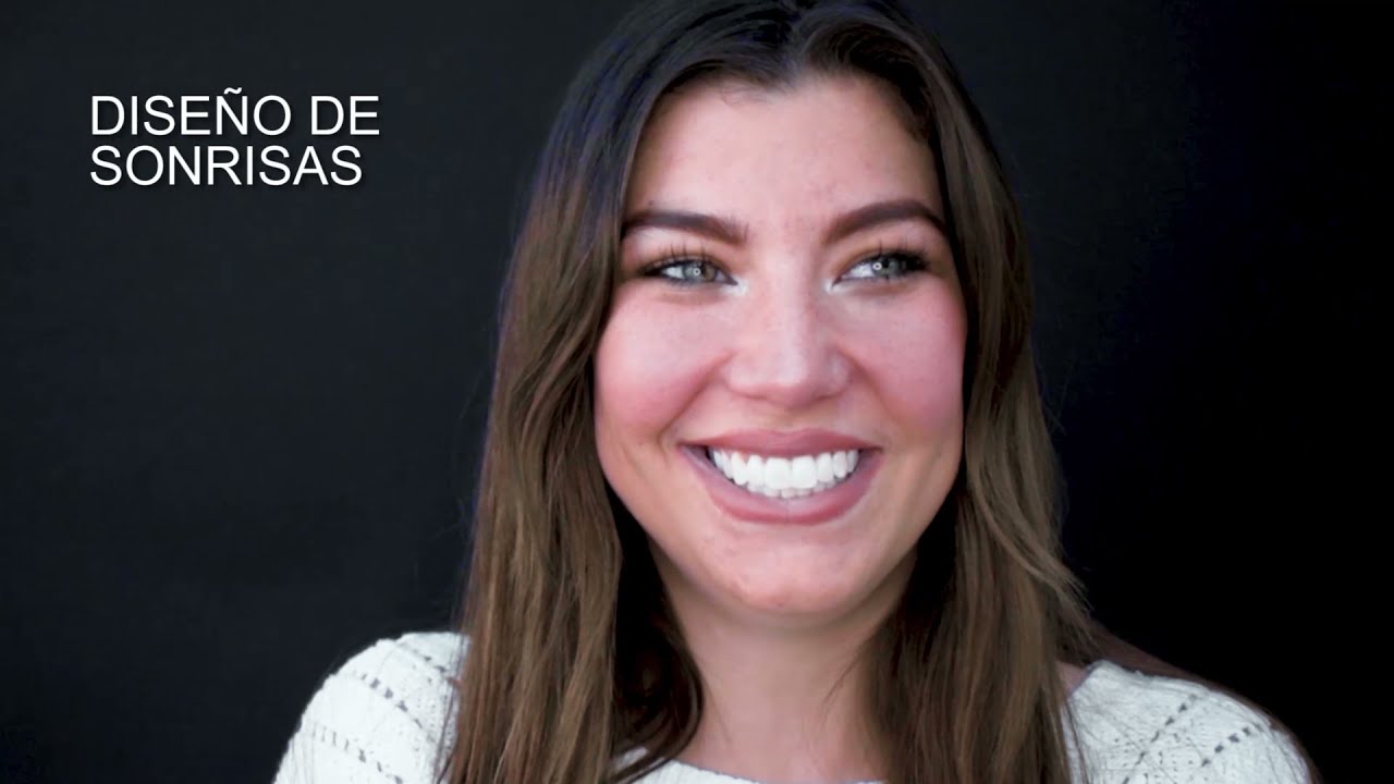 Diseño de Sonrisa | Centro Dental Querétaro ▷ La Sonrisa que Siempre has Querido