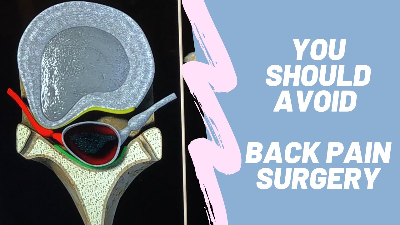 What are the different types of back surgery | Which back pain requires surgery | Dr Casey Bearden