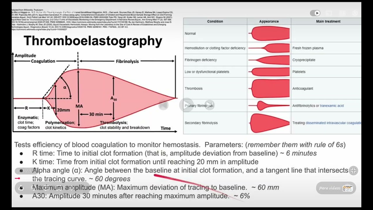 Massive transfusion protocol  TEG and anaphylaxis 