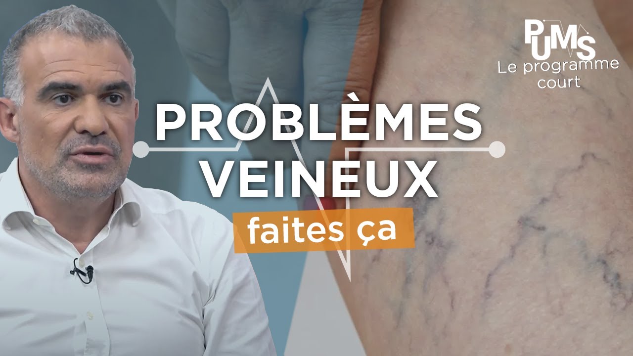 Ces signes révèlent que VOS VEINES fonctionnent mal; voici comment AGIR jambes lourdes, varices...
