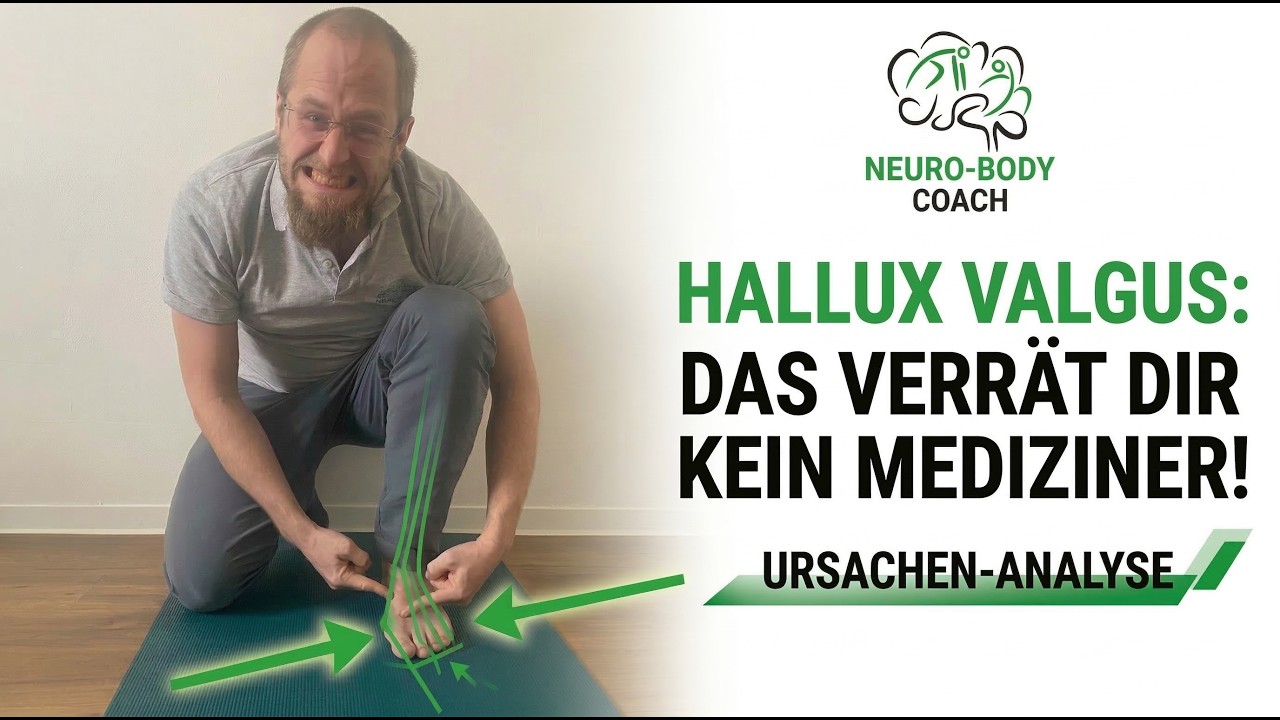 Hallux Valgus - Das verrät dir kein Medizinier