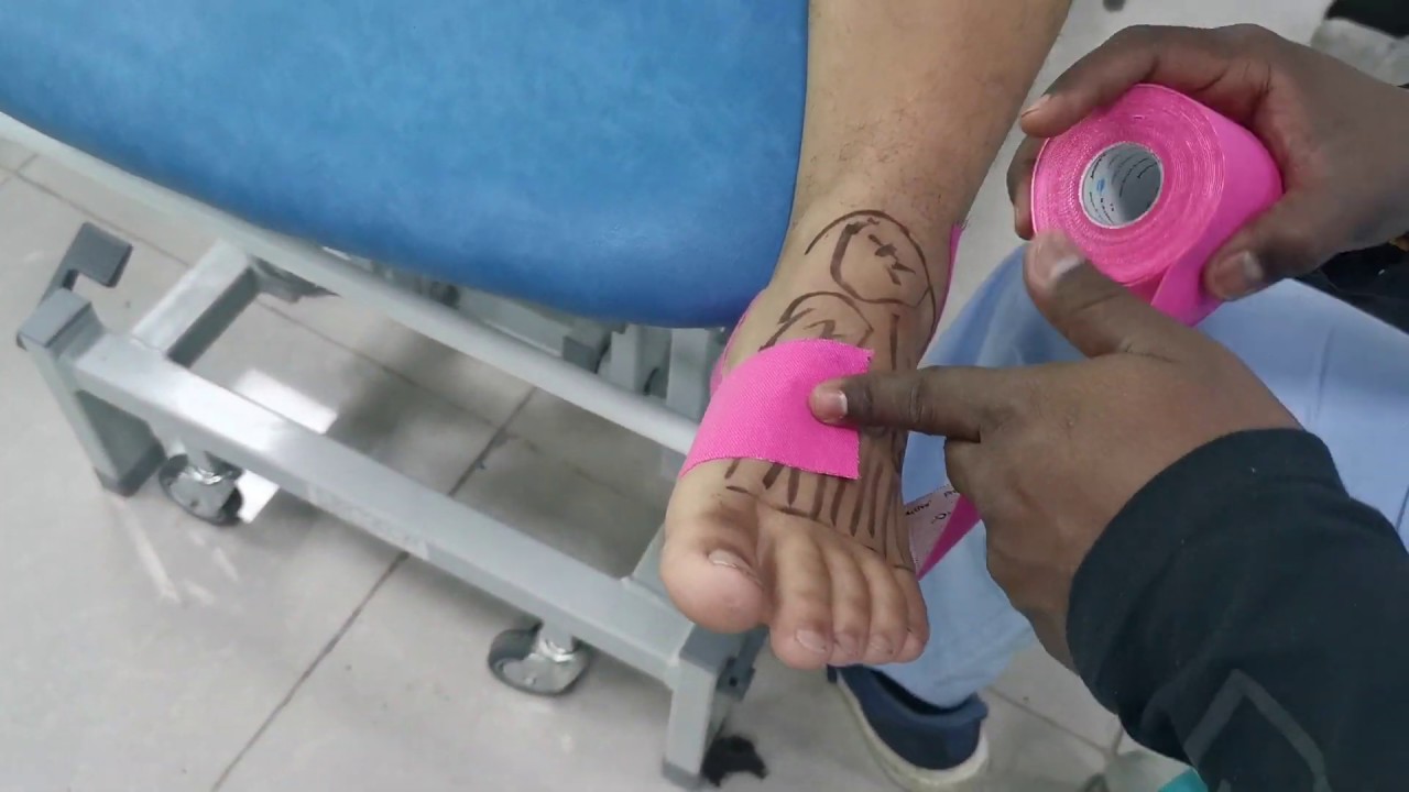 Club foot treatment for Pediatric