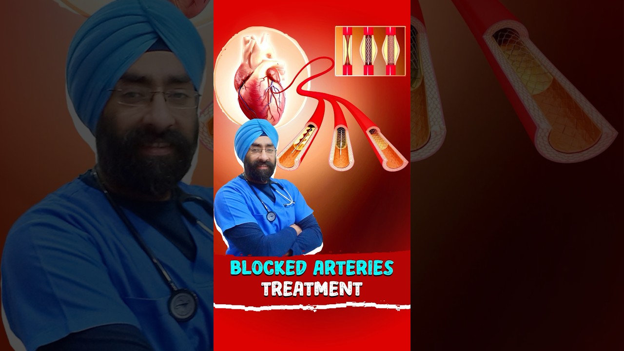 How Is Angioplasty Procedure Performed? #shorts #hearthealth