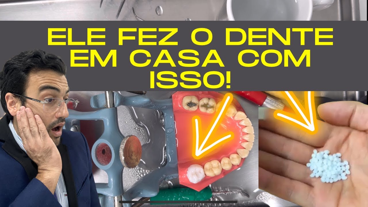 DENTISTA REAGE E TESTA NOVO MATERIAL PARA FAZER DENTE EM CASA!