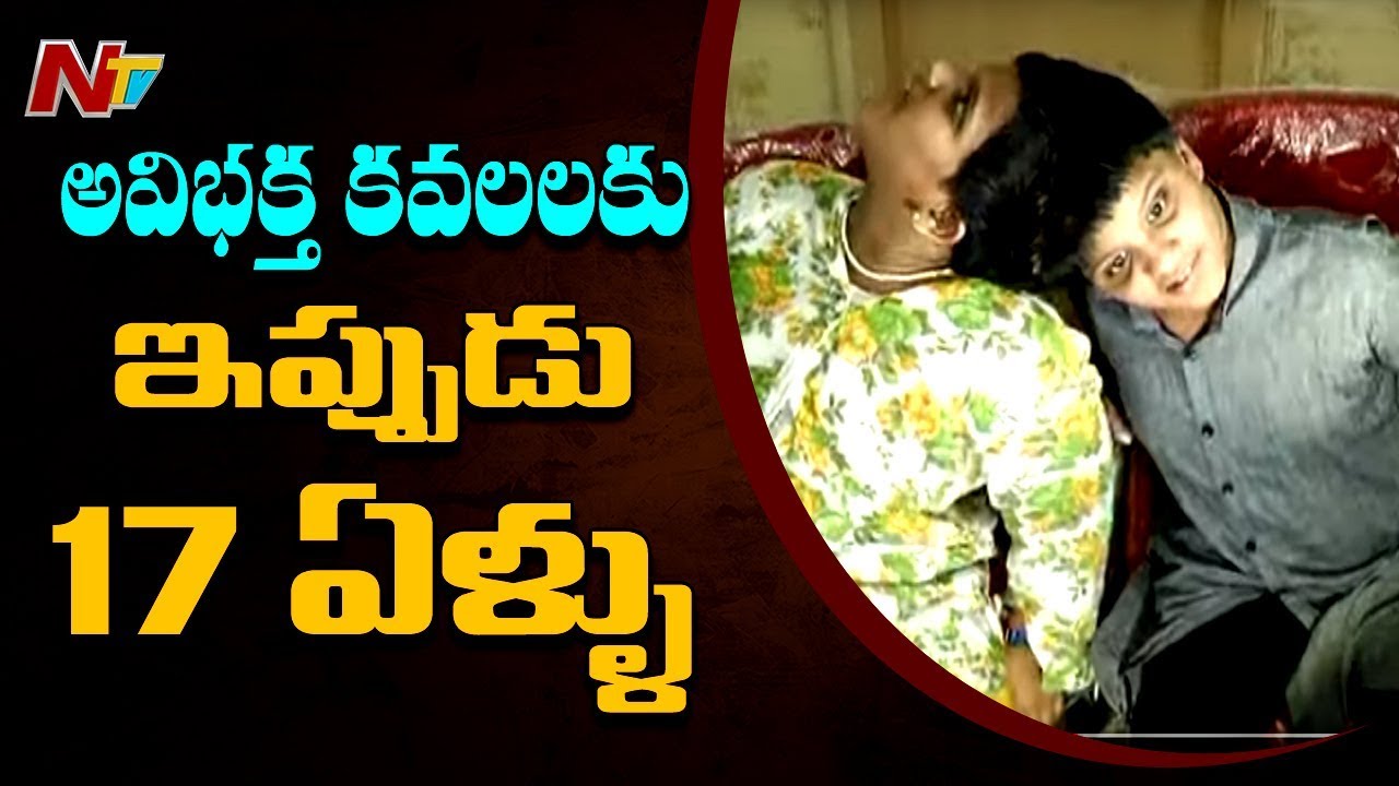అవిభక్త కవలలు వీణావాణీలకు 17 ఏళ్ళు || Special Focus || NTV