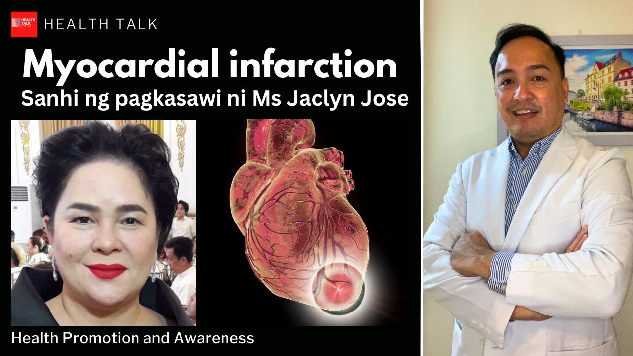 Myocardial infarction: Sanhi ng pagkasawi ni Ms Jaclyn Jose