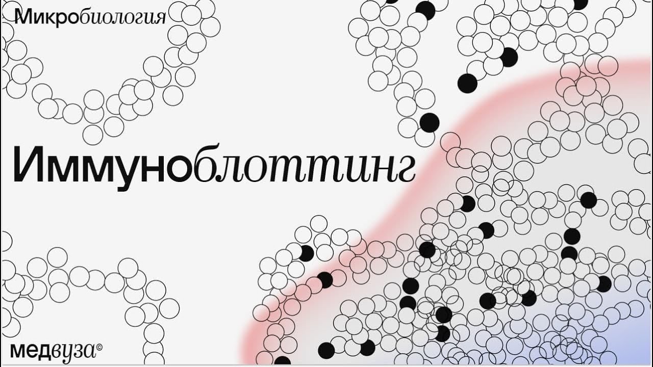 Иммуноблоттинг: компоненты и механизм метода | Микробиология