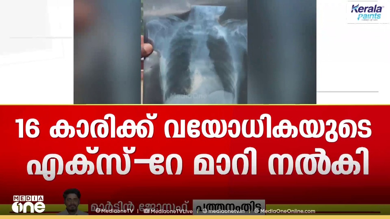 16-year-old girl given X-ray of elderly woman; doctor also gave her medicine; serious medical error
