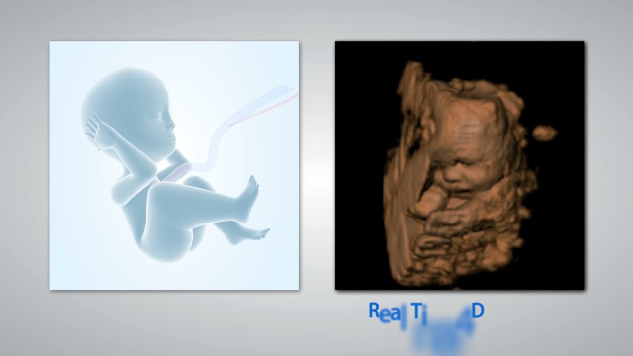 Ecógrafo Portátil SonoScape S9 - Doppler Color Avanzado, Cardiología, 3D / 4D