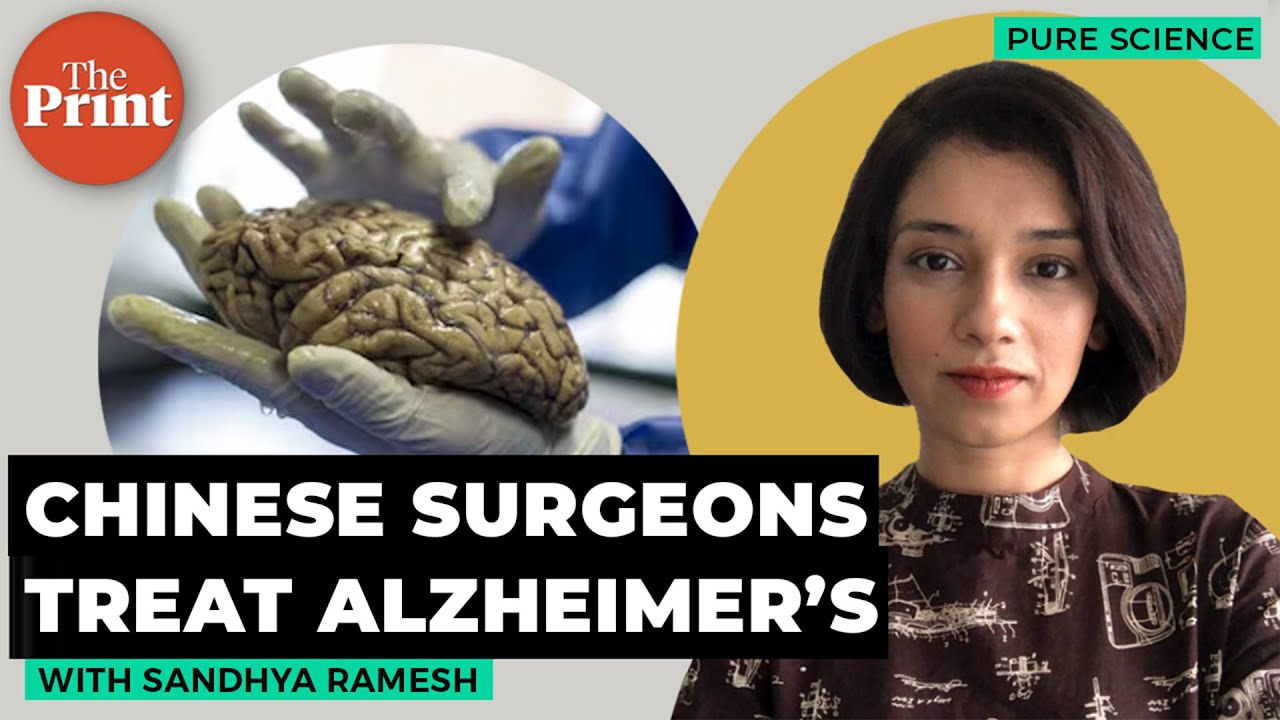 Chinese surgeons treat Alzheimer's leading to drastic improvement in cognition