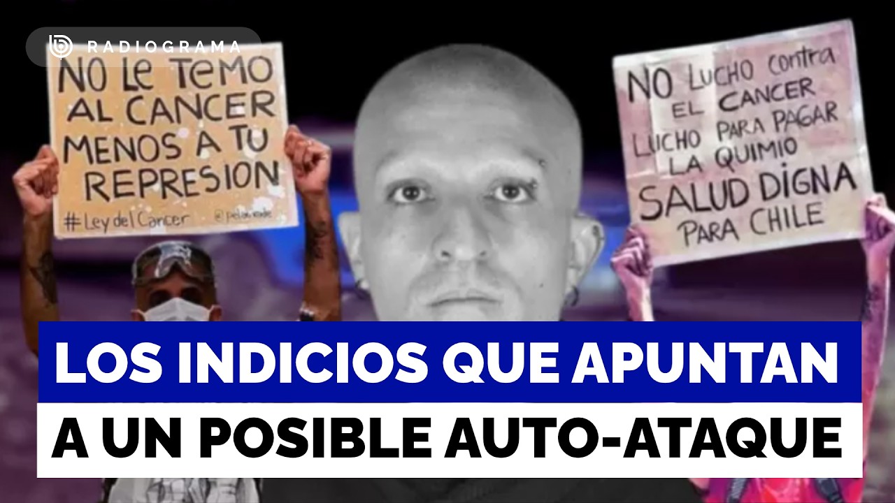 Los indicios que apuntan a un posible auto-ataque de Rodrigo Rojas Vade