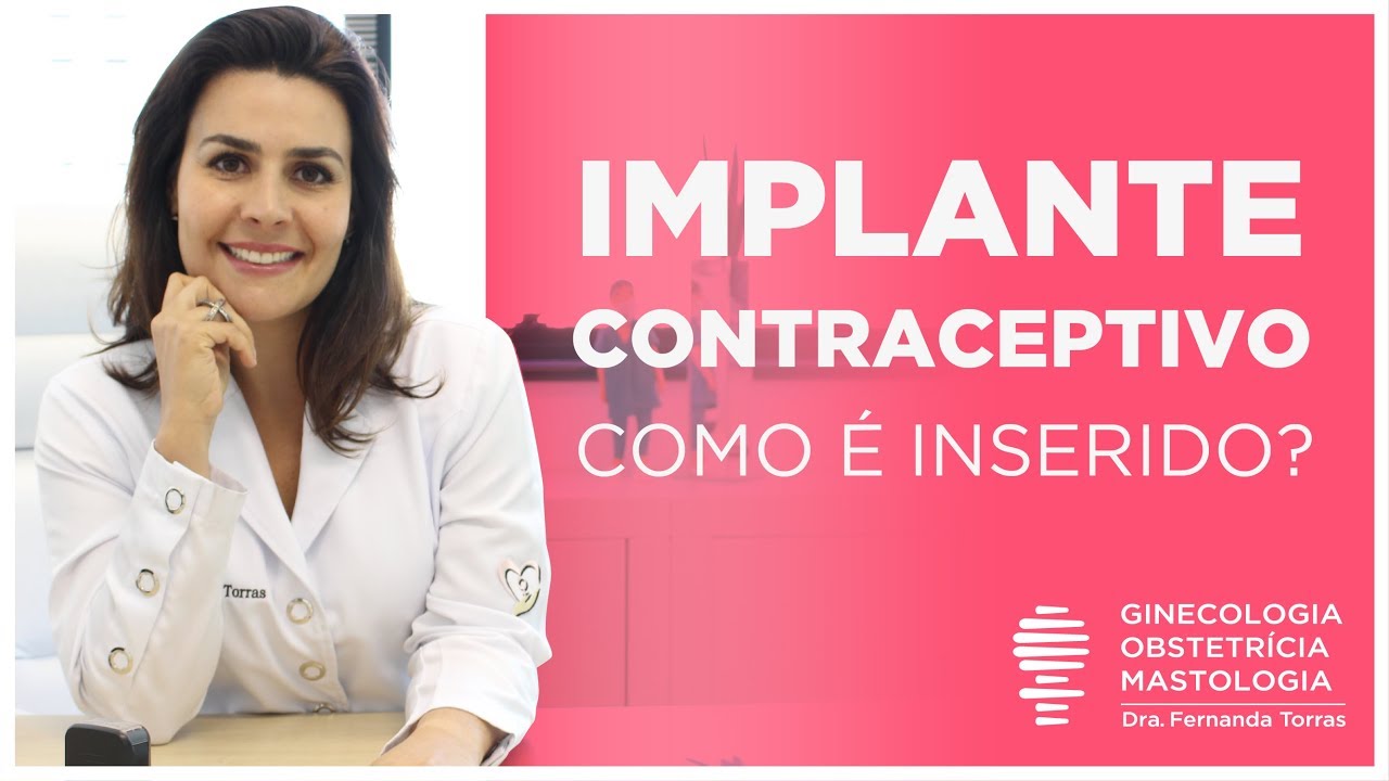 IMPLANON | Como é colocado o Implante Anticoncepcional?