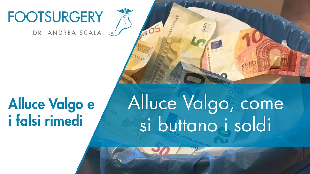 Alluce Valgo rimedi: correttori, plantari e cerotti | Come correggere l'alluce valgo | Dott. Scala