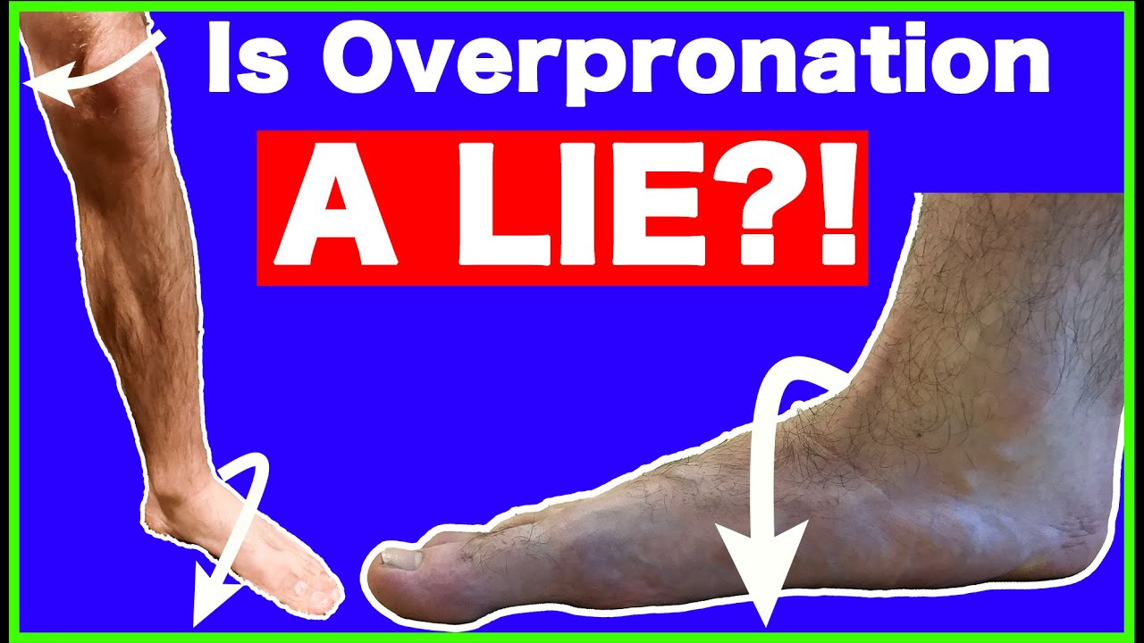 Overpronation is a LIE - Here&rsquo;s Why