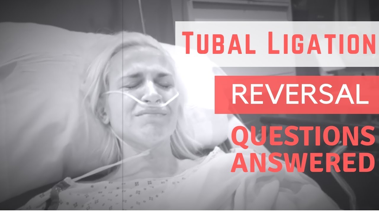 TUBAL LIGATION REVERSAL | Question & Answers (Results & expectations Q&A)