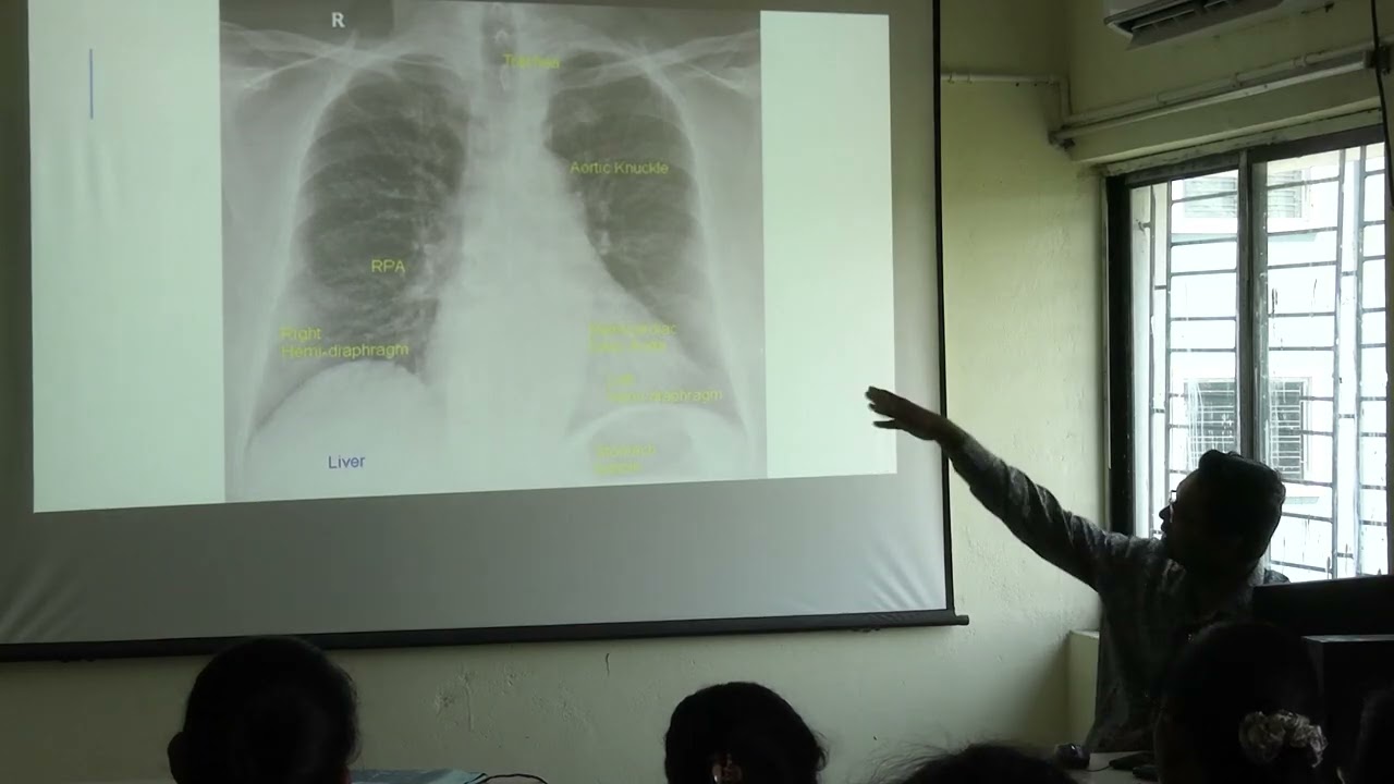 MBBS Class (2022-2023 Batch) Of Santiniketan Medical College & Hospital