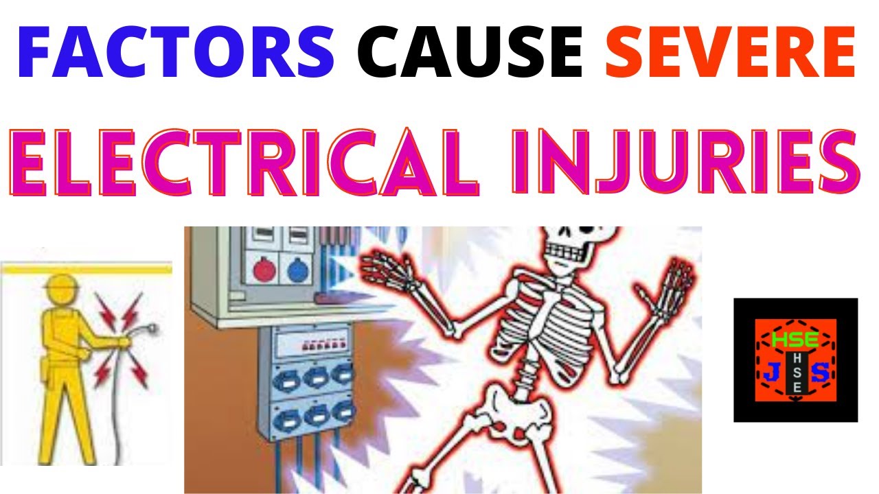 Electrical Safety | Factors for severe Electric Shock & Injury #shorts #safetyfirstlife Bright side