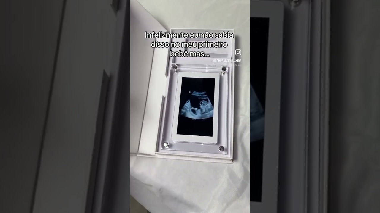 SE VOC&Ecirc; ESTA GR&Aacute;VIDA EM 2024, N&Atilde;O COMETA ESSE ERRO!!!