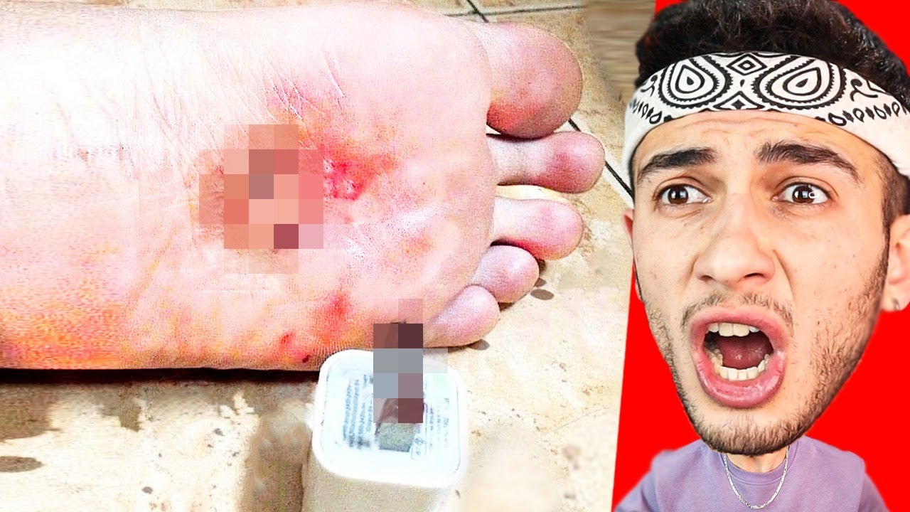 SİNİRLENMEME CHALLENGE... (ÇOK ZOR)