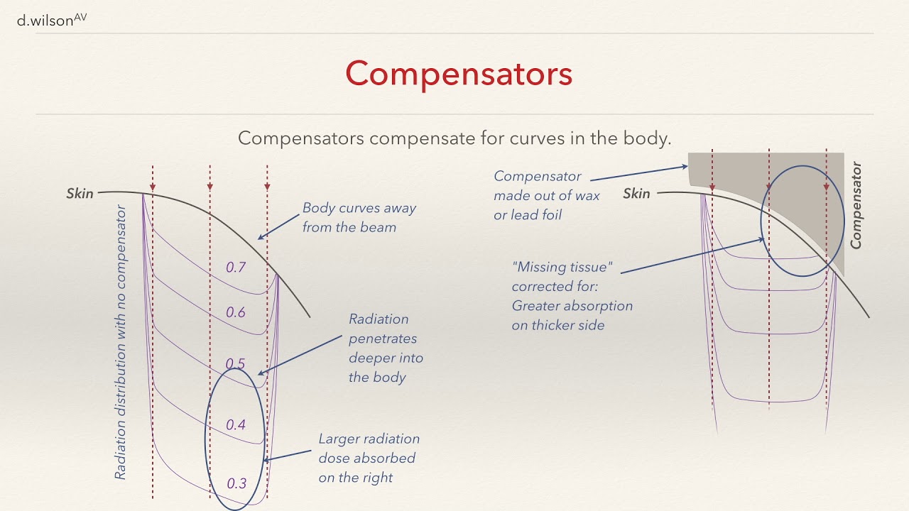 Radiotherapy Compensators and Wedges - What they do