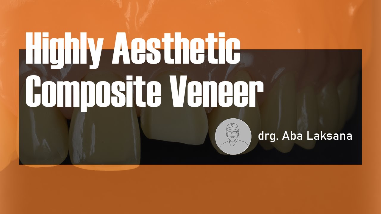 Direct Composite Veneer with 2 Layers Technique  | Dental Aesthetic Restoration (AMARIS®  VOCO GmbH)