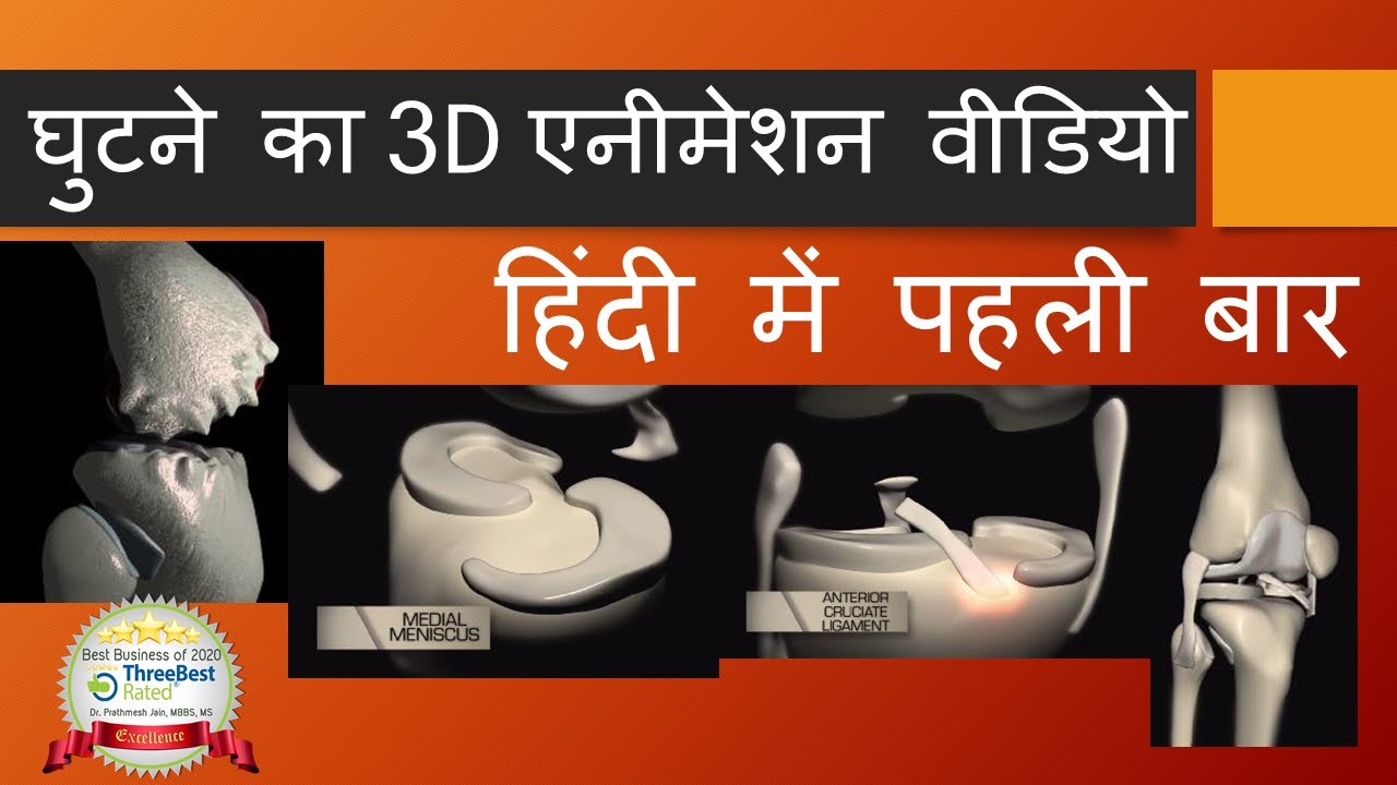 घुटने का 3D एनीमेशन वीडियो : हिंदी में पहली बार Knee Animation Video Hindi