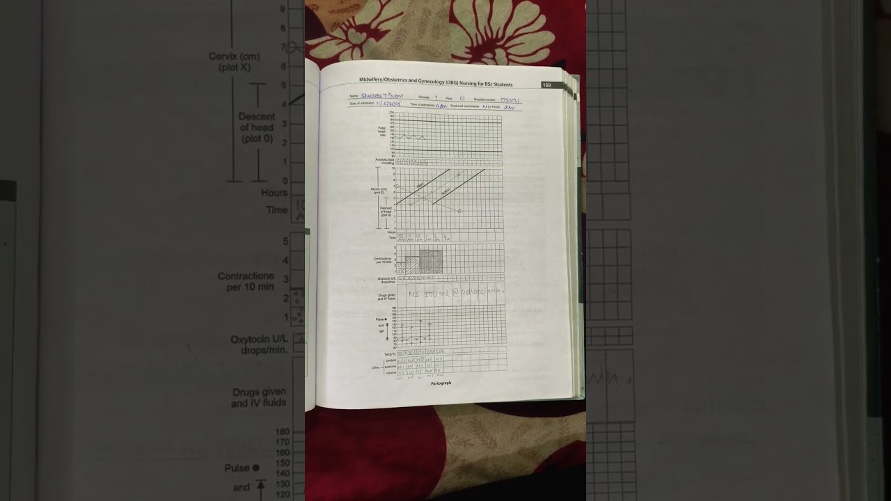 Assessment And Conduction Of Normal Childbirth 7&8 @visionpublicschool   @OBG case book