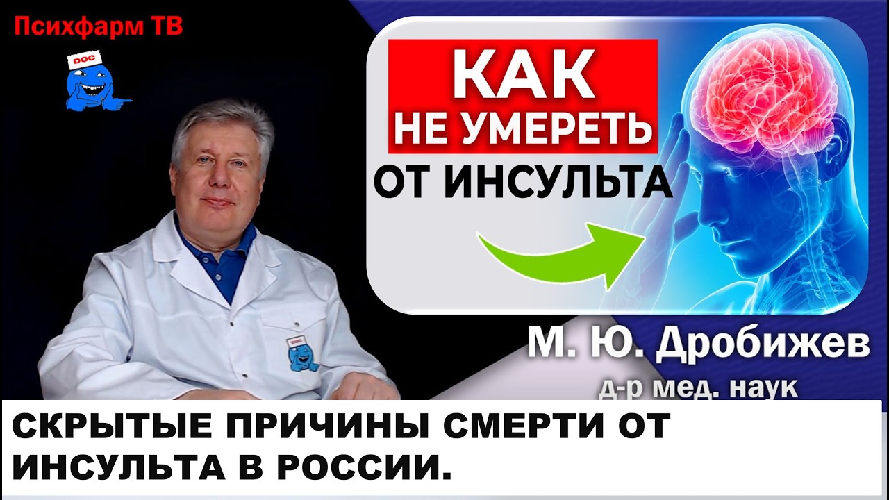 Скрытые причины смерти от инсульта в России.