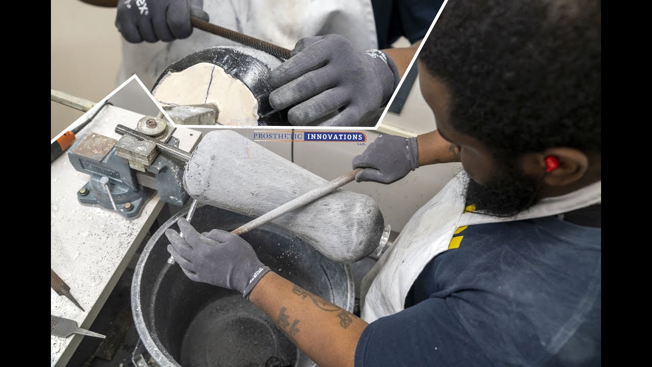 Prosthetic Innovations | On Site Fabrication | Prosthetic Technicians