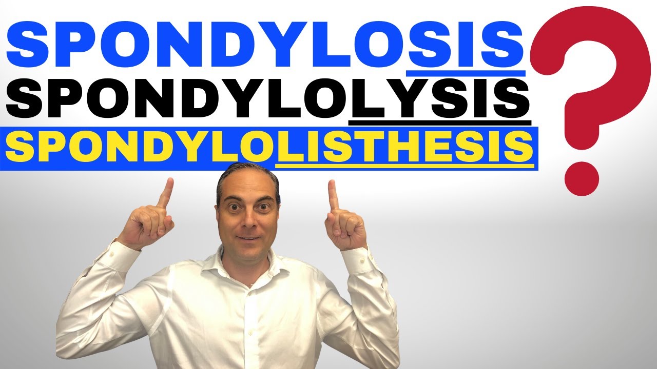 Difference Between Spondylosis Spondylolysis Spondylolisthesis EXPLAINED by Dr. Walter Salubro