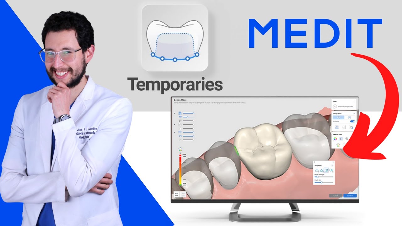 Provisionales 3D GRATIS - Como hacer provisionales dentales para impresión 3D