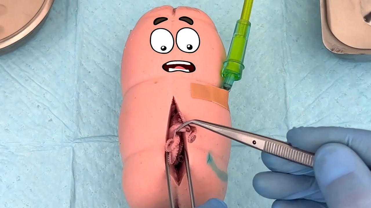 Shocking Revelation: Doodles Expose Food Surgery Secrets!