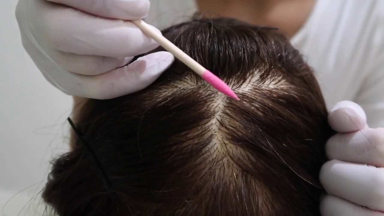 ASMR |Hypnosis Scalp Scratching Sounds |Helping You Fall Asleep |Stress Relief| No Talking| Binaural