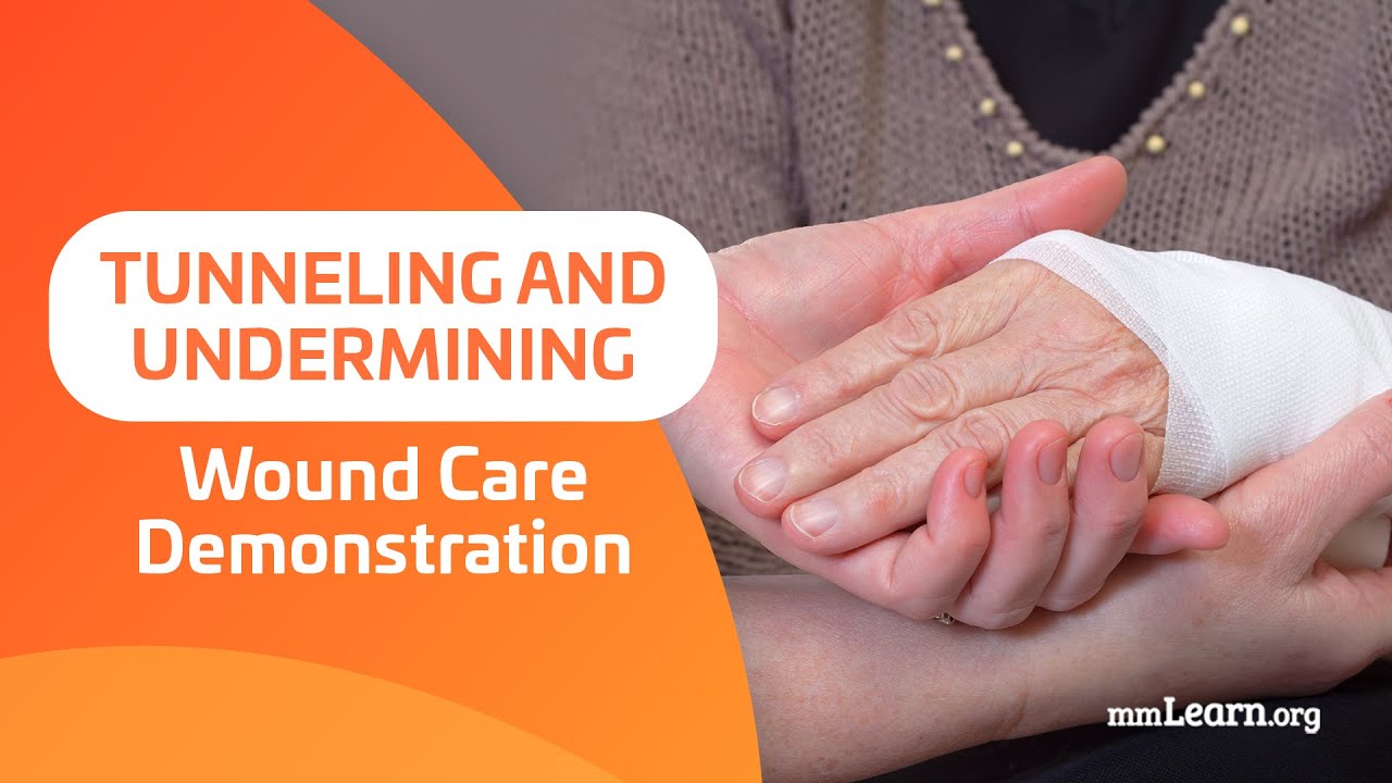 Tunneling and Undermining - Wound Care Demonstration