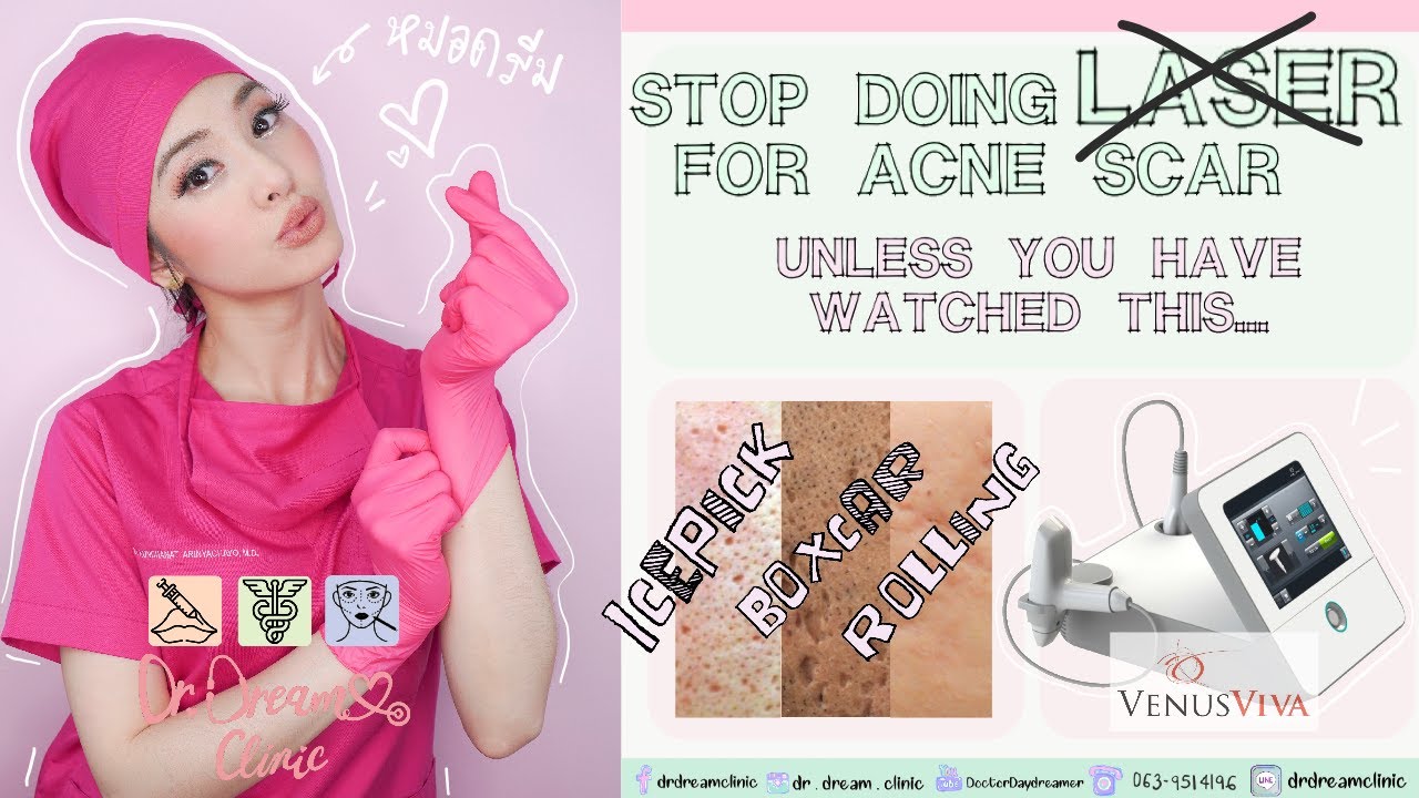 #Acne Scar ? Stop doing LASER..unless you have watched this | Dr. Dream Clinic x #VenusViva