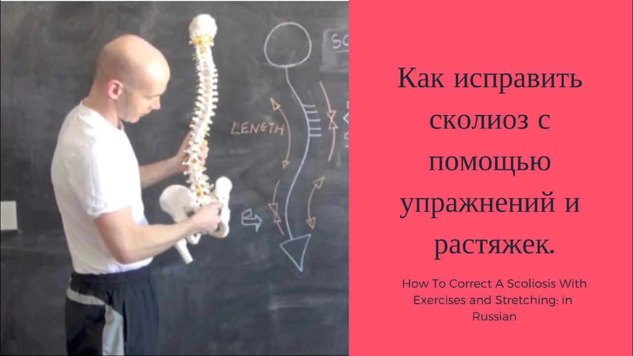 In Russian: Как исправить сколиоз с помощью упражнений и растяжек.