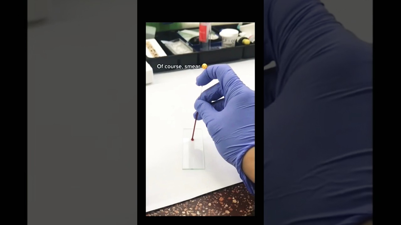 Blood count microscopy. #youtubeshorts #labtechnicians #microscope #shorts #trading #laboratory #lab