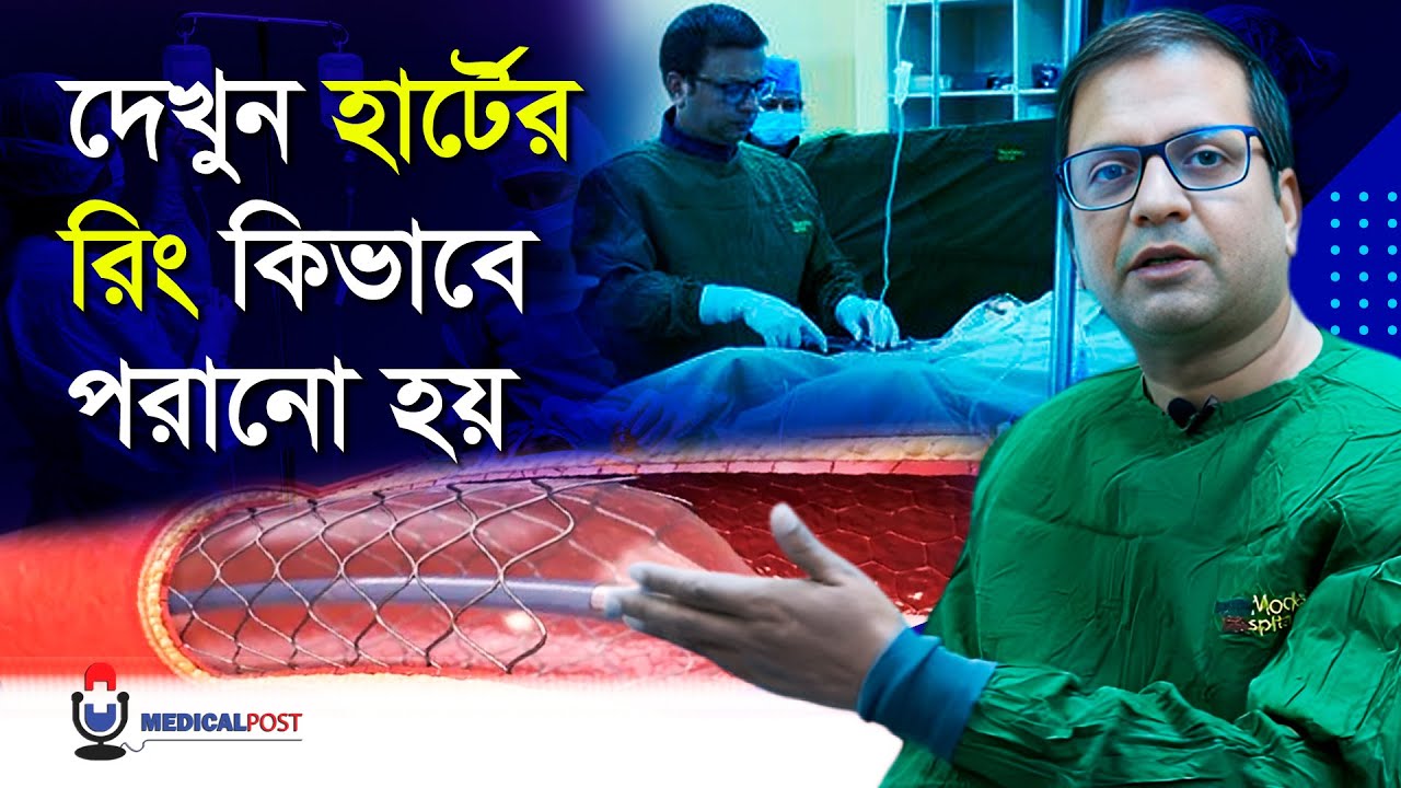 হার্টের রিং কিভাবে পরানো হয় সরাসরি ভিডিও | Heart Ring Live Surgery | Medical Post
