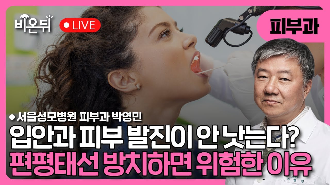 잘 낫지 않는 입안과 피부 발진&hellip; &lsquo;편평태선&rsquo;? 방치하면 위험한 이유? / 서울성모병원 피부과 박영민
