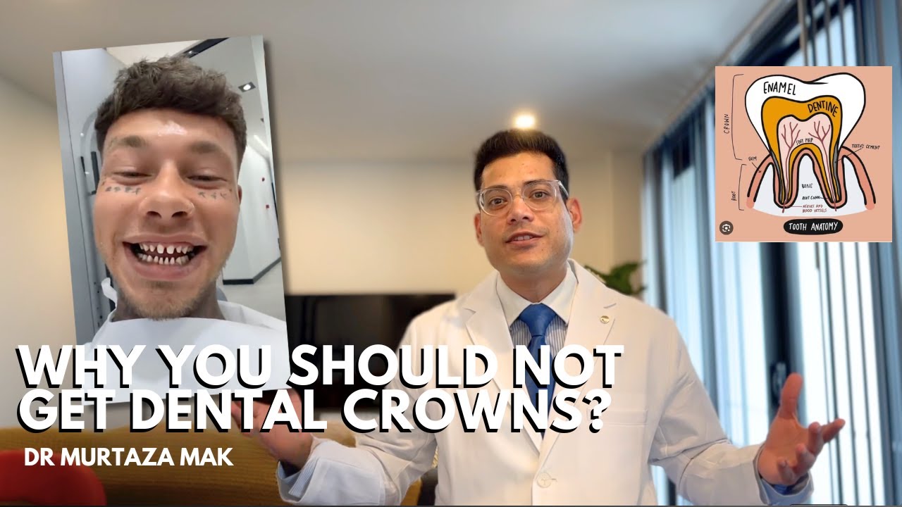 Why You Should Not Get Dental Crowns? The Unfortunate Truth