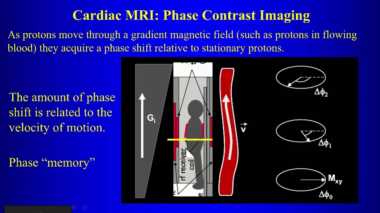 5b Cardiac MRI P2