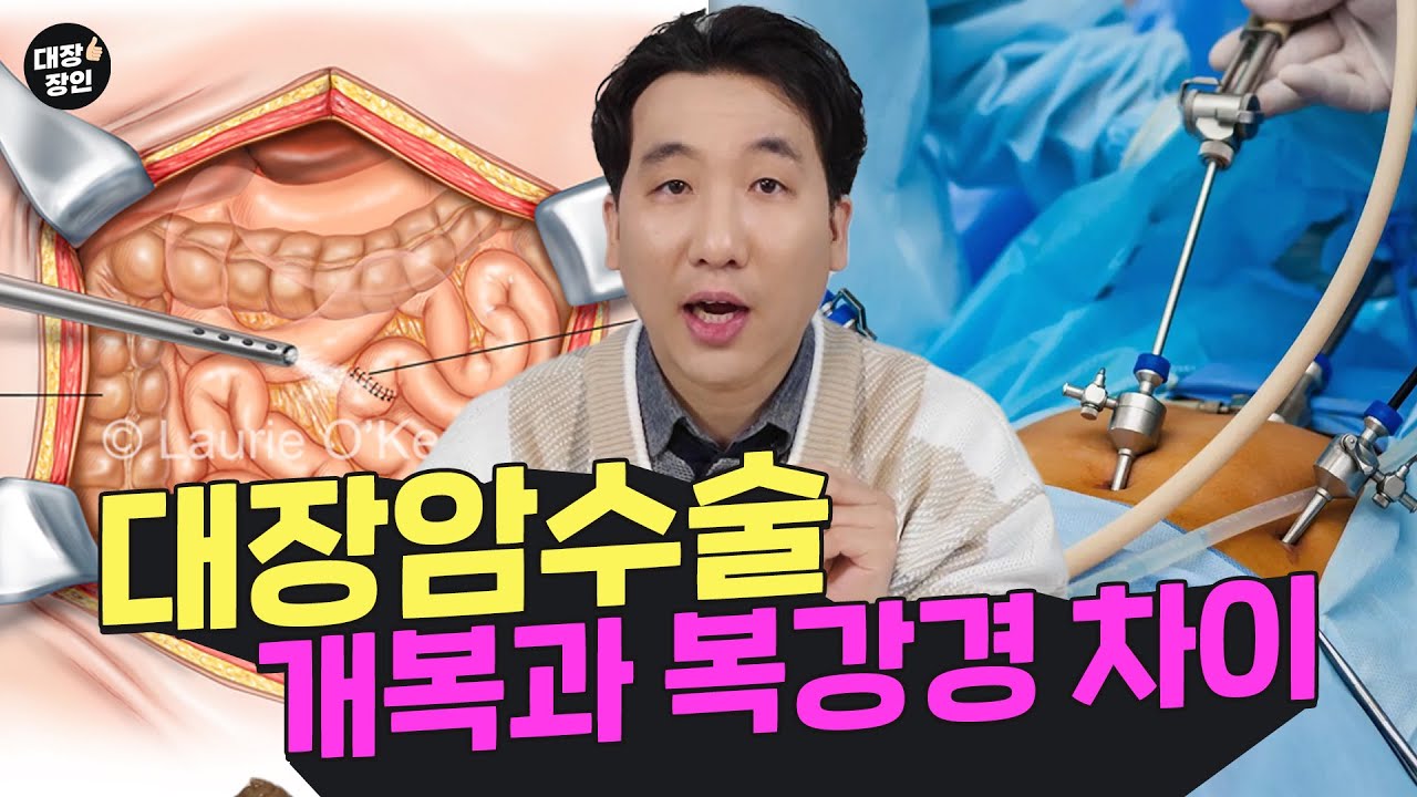 뱃속 암, 개복과 복강경 수술의 차이