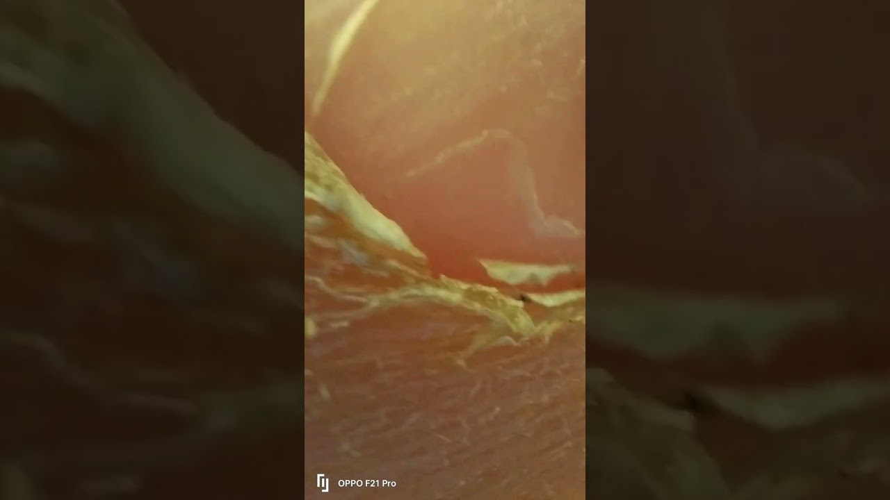 my thumb in microscope #shorts #microboy #viral