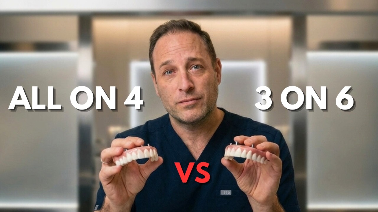 All-on-4 Dental Implants vs 3-on-6: Which Is Better?